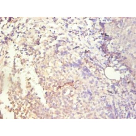Immunohistochemistry - IL8 Monoclonal Antibody from Signalway Antibody (42041) - Antibodies.com