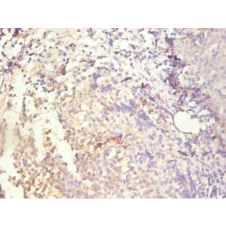 Immunohistochemistry - IL8 Monoclonal Antibody from Signalway Antibody (42041) - Antibodies.com