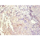 Immunohistochemistry - IL8 Monoclonal Antibody from Signalway Antibody (42041) - Antibodies.com