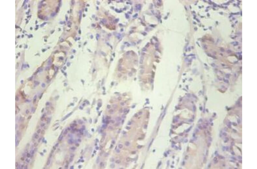 Immunohistochemistry - IL8 Monoclonal Antibody from Signalway Antibody (42041) - Antibodies.com
