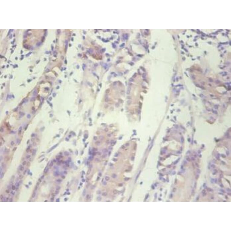 Immunohistochemistry - IL8 Monoclonal Antibody from Signalway Antibody (42041) - Antibodies.com