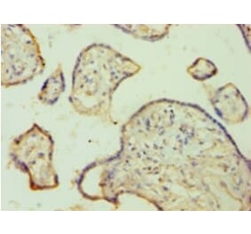 Immunohistochemistry - FGA Polyclonal Antibody from Signalway Antibody (42168) - Antibodies.com