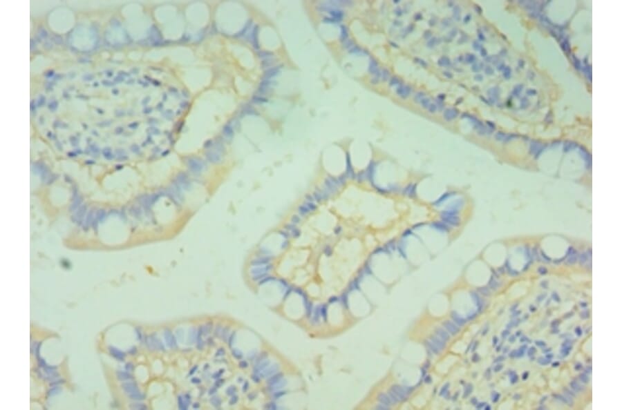 Immunohistochemistry - BOC Polyclonal Antibody from Signalway Antibody (42679) - Antibodies.com