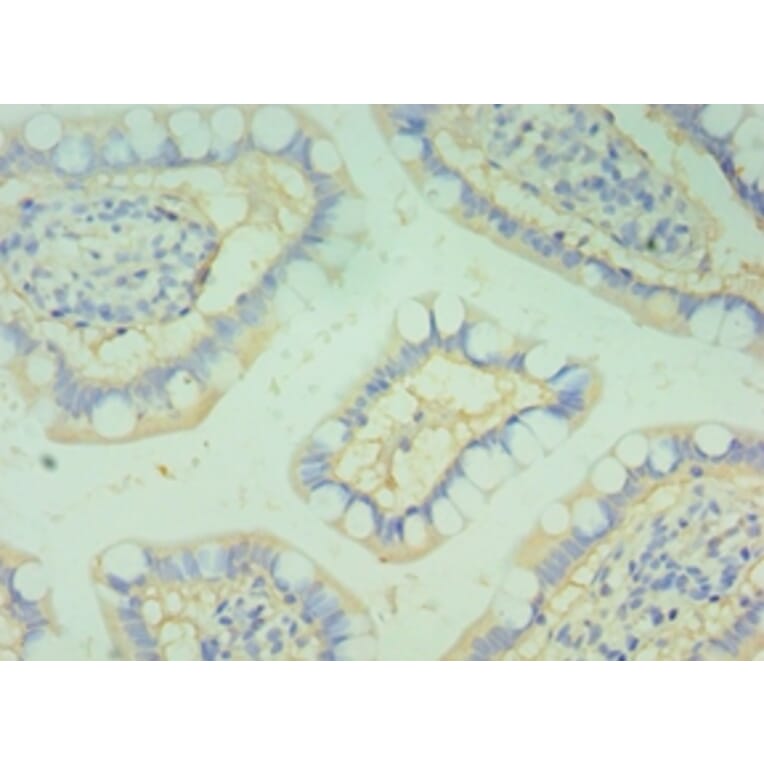 Immunohistochemistry - BOC Polyclonal Antibody from Signalway Antibody (42679) - Antibodies.com