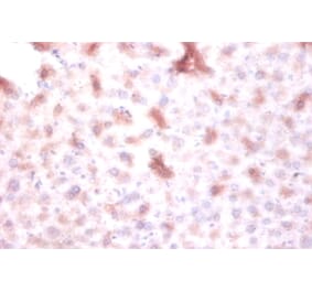 Immunohistochemistry - DTW domain-containing protein 1 Polyclonal Antibody from Signalway Antibody (42153)