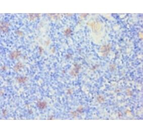 Immunohistochemistry - Keratin, type I cytoskeletal 14 Polyclonal Antibody from Signalway Antibody (42234)