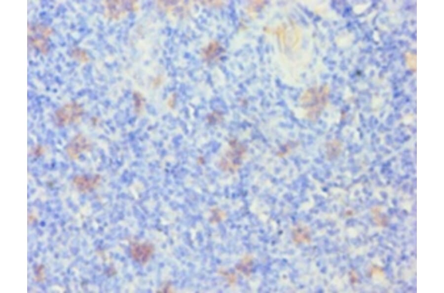 Immunohistochemistry - Keratin, type I cytoskeletal 14 Polyclonal Antibody from Signalway Antibody (42234)