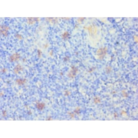 Immunohistochemistry - Keratin, type I cytoskeletal 14 Polyclonal Antibody from Signalway Antibody (42234)