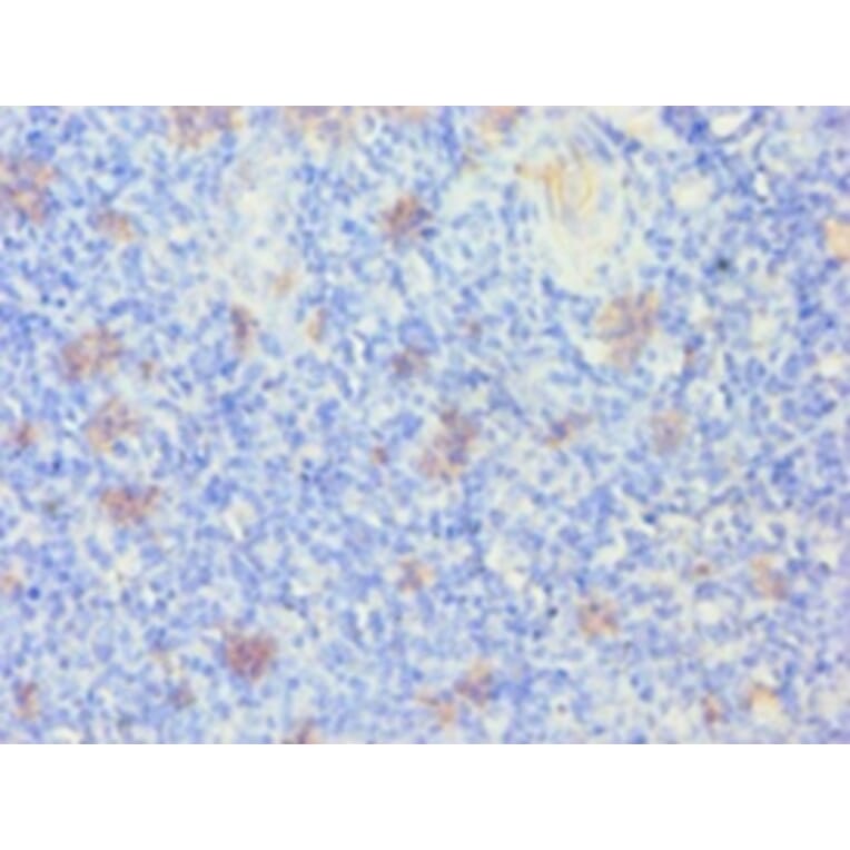 Immunohistochemistry - Keratin, type I cytoskeletal 14 Polyclonal Antibody from Signalway Antibody (42234)