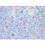 Immunohistochemistry - Keratin, type I cytoskeletal 14 Polyclonal Antibody from Signalway Antibody (42234)