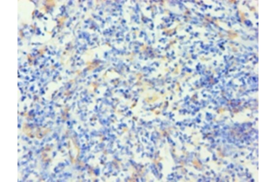 Immunohistochemistry - Keratin, type I cytoskeletal 14 Polyclonal Antibody from Signalway Antibody (42234)