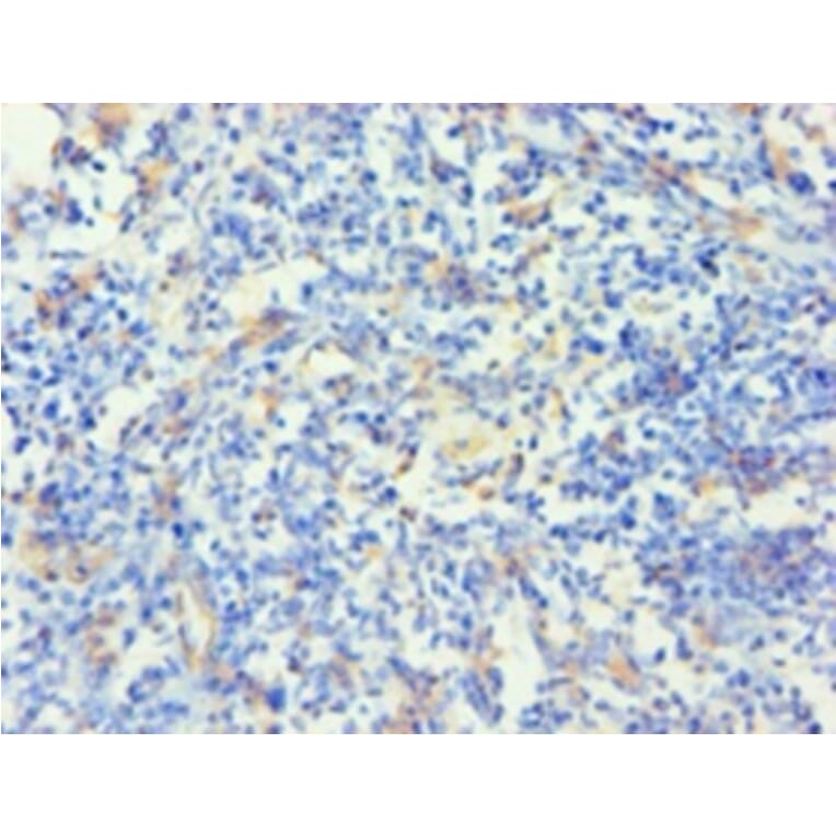 Immunohistochemistry - Keratin, type I cytoskeletal 14 Polyclonal Antibody from Signalway Antibody (42234)