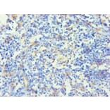 Immunohistochemistry - Keratin, type I cytoskeletal 14 Polyclonal Antibody from Signalway Antibody (42234)