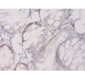 Immunohistochemistry - Connective tissue growth factor Polyclonal Antibody from Signalway Antibody (42506)