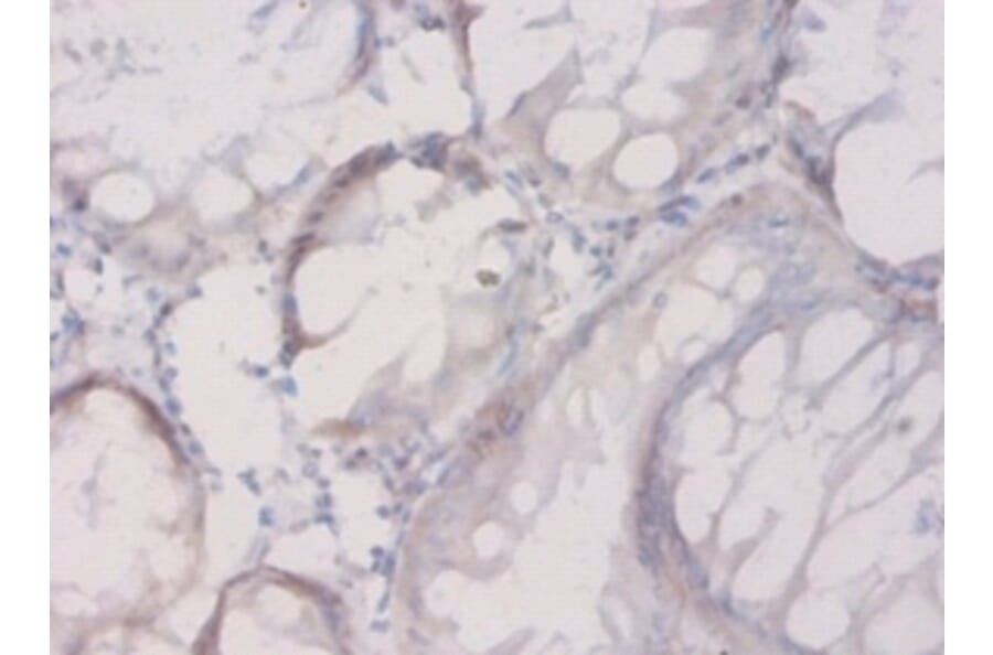 Immunohistochemistry - Connective tissue growth factor Polyclonal Antibody from Signalway Antibody (42506)