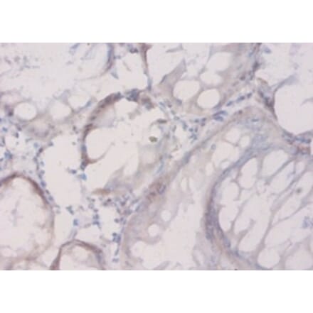 Immunohistochemistry - Connective tissue growth factor Polyclonal Antibody from Signalway Antibody (42506)