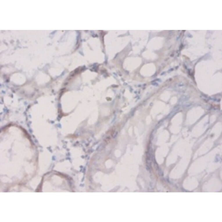 Immunohistochemistry - Connective tissue growth factor Polyclonal Antibody from Signalway Antibody (42506)