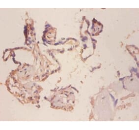 Immunohistochemistry - Cell surface glycoprotein MUC18 Polyclonal Antibody from Signalway Antibody (42523)