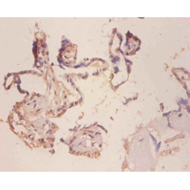 Immunohistochemistry - Cell surface glycoprotein MUC18 Polyclonal Antibody from Signalway Antibody (42523)