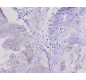 Immunohistochemistry - Lysyl oxidase homolog 1 Polyclonal Antibody from Signalway Antibody (42241) - Antibodies.com