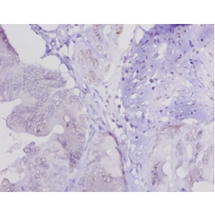 Immunohistochemistry - Lysyl oxidase homolog 1 Polyclonal Antibody from Signalway Antibody (42241) - Antibodies.com