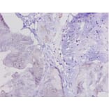 Immunohistochemistry - Lysyl oxidase homolog 1 Polyclonal Antibody from Signalway Antibody (42241) - Antibodies.com
