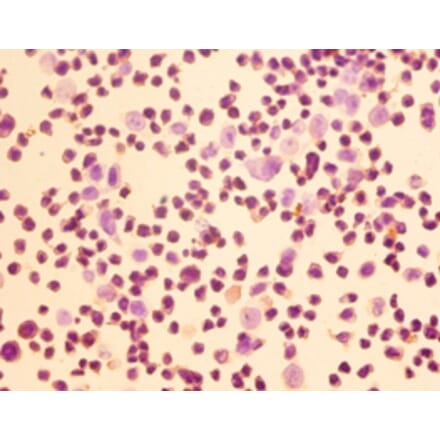 Immunohistochemistry - Homer protein homolog 1 Polyclonal Antibody from Signalway Antibody (42382) - Antibodies.com