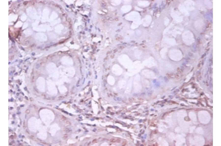 Immunohistochemistry - Amyloid beta A4 protein Polyclonal Antibody from Signalway Antibody (42478) - Antibodies.com