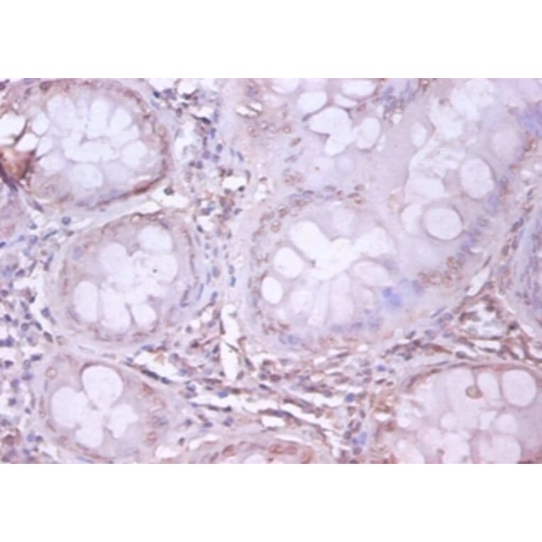 Immunohistochemistry - Amyloid beta A4 protein Polyclonal Antibody from Signalway Antibody (42478) - Antibodies.com