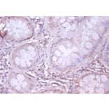 Immunohistochemistry - Amyloid beta A4 protein Polyclonal Antibody from Signalway Antibody (42478) - Antibodies.com