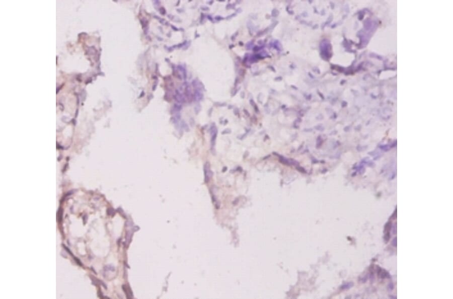 Immunohistochemistry - Laminin subunit gamma-1 Polyclonal Antibody from Signalway Antibody (42540) - Antibodies.com