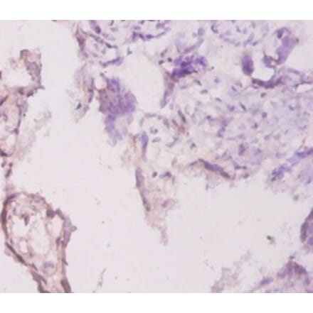 Immunohistochemistry - Laminin subunit gamma-1 Polyclonal Antibody from Signalway Antibody (42540) - Antibodies.com