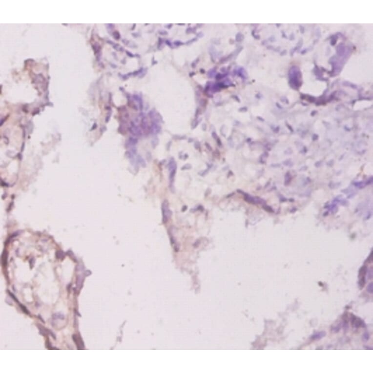 Immunohistochemistry - Laminin subunit gamma-1 Polyclonal Antibody from Signalway Antibody (42540) - Antibodies.com