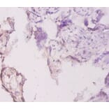 Immunohistochemistry - Laminin subunit gamma-1 Polyclonal Antibody from Signalway Antibody (42540) - Antibodies.com