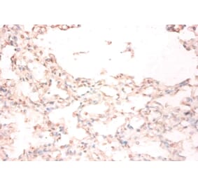 Immunohistochemistry - Metalloreductase STEAP1 Polyclonal Antibody from Signalway Antibody (42568) - Antibodies.com