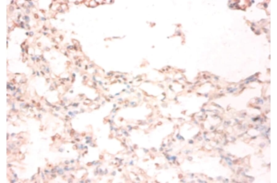 Immunohistochemistry - Metalloreductase STEAP1 Polyclonal Antibody from Signalway Antibody (42568) - Antibodies.com