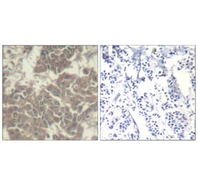 Immunohistochemistry - Jak2 (Ab-570) Antibody from Signalway Antibody (21522) - Antibodies.com