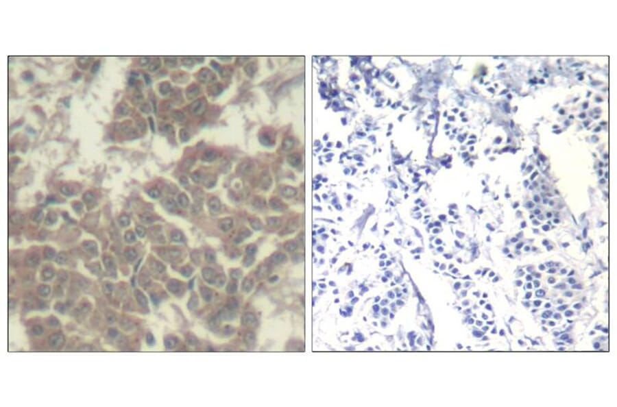 Immunohistochemistry - Jak2 (Ab-570) Antibody from Signalway Antibody (21522) - Antibodies.com