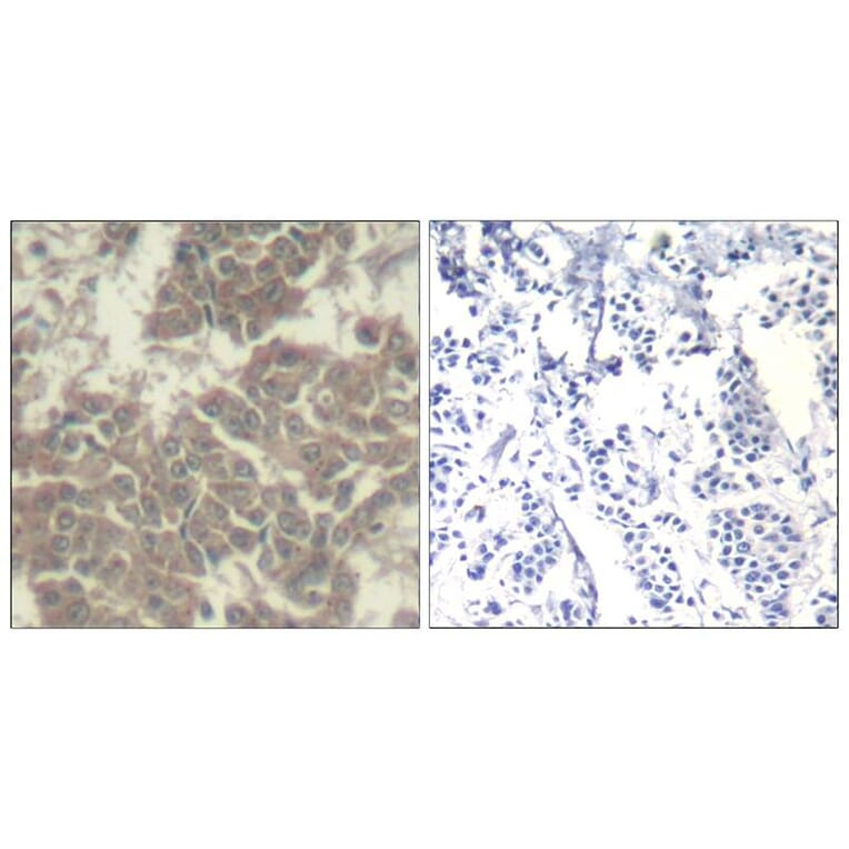 Immunohistochemistry - Jak2 (Ab-570) Antibody from Signalway Antibody (21522) - Antibodies.com