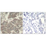 Immunohistochemistry - Jak2 (Ab-570) Antibody from Signalway Antibody (21522) - Antibodies.com