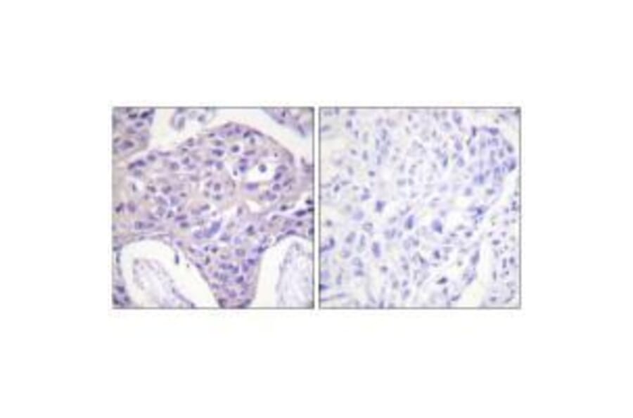 Immunohistochemistry - FOXO1/3/4-pan Antibody from Signalway Antibody (33135) - Antibodies.com