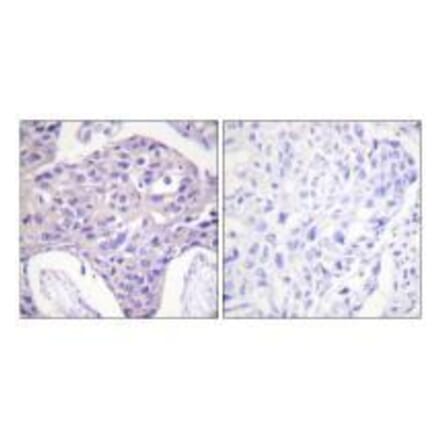 Immunohistochemistry - FOXO1/3/4-pan Antibody from Signalway Antibody (33135) - Antibodies.com