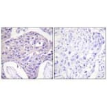 Immunohistochemistry - FOXO1/3/4-pan Antibody from Signalway Antibody (33135) - Antibodies.com