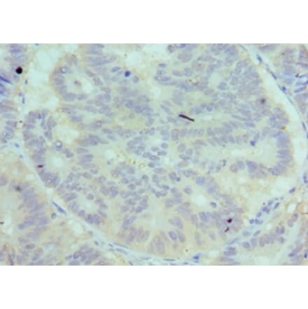 Immunohistochemistry - C7 Polyclonal Antibody from Signalway Antibody (42095) - Antibodies.com