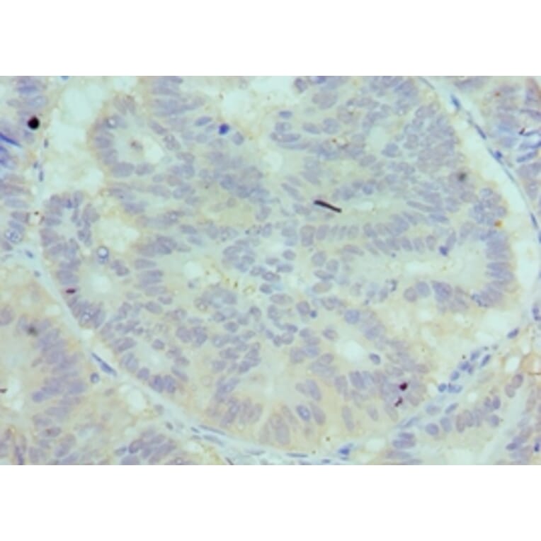 Immunohistochemistry - C7 Polyclonal Antibody from Signalway Antibody (42095) - Antibodies.com