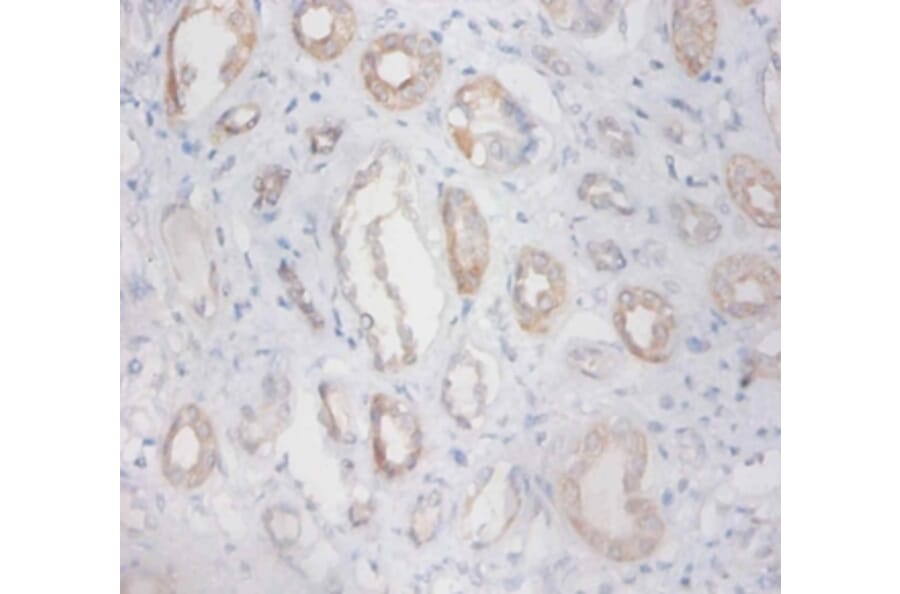 Immunohistochemistry - Zinc finger protein 91 Polyclonal Antibody from Signalway Antibody (42310) - Antibodies.com