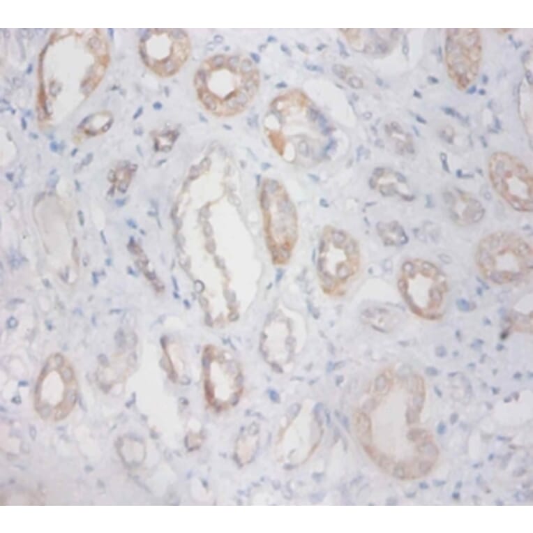 Immunohistochemistry - Zinc finger protein 91 Polyclonal Antibody from Signalway Antibody (42310) - Antibodies.com