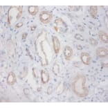 Immunohistochemistry - Zinc finger protein 91 Polyclonal Antibody from Signalway Antibody (42310) - Antibodies.com