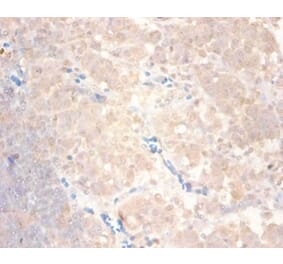 Immunohistochemistry - C-C motif chemokine 24 Polyclonal Antibody from Signalway Antibody (42444) - Antibodies.com