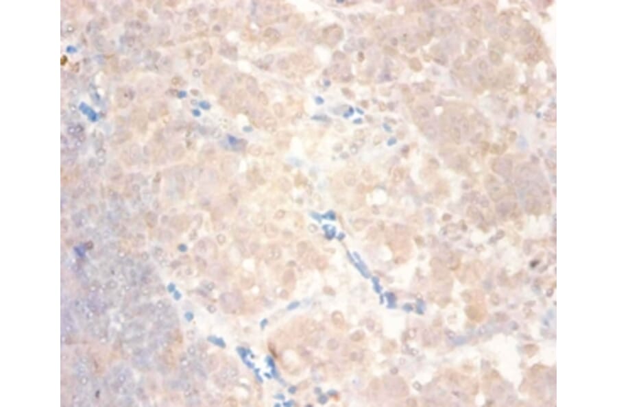 Immunohistochemistry - C-C motif chemokine 24 Polyclonal Antibody from Signalway Antibody (42444) - Antibodies.com